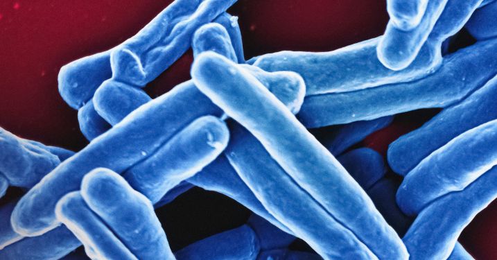 Mycobacterium Tuberculosis Bacteria Scanning electron micrograph of Mycobacterium tuberculosis particles (colorized blue), the bacterium which causes TB. 